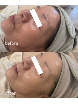 レアビューティー(Le'a beauty)/リフトアップ・シルク艶肌