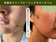 アンテサロン 関内店(Antesalon)/選べるモデリングマスクで鎮静◎