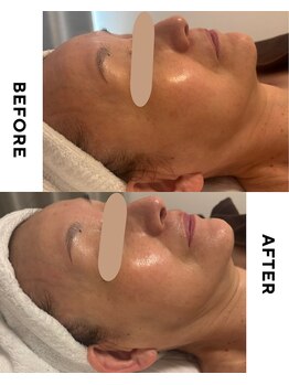 ハロネ(Halone’)/【正規LDM】韓国肌管理