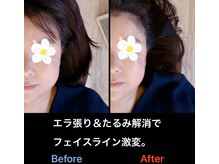 美容矯正サロン レレポノ(LELEPONO)/