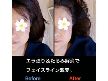 美容矯正サロン レレポノ(LELEPONO)/