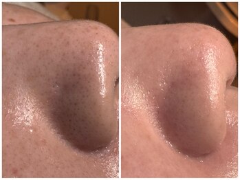 サラグランデ(Sara Grande)/90分でちゅるん肌かんせ!