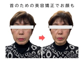サロン ド マナ 兵庫(salon de MANA)/首を美しくするための美容矯正