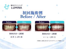 ルミナ 蒲田店(LUMINA)の雰囲気（今の歯の白さは？ビフォーアフターもしっかりチェックします！）