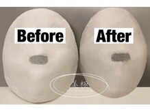 美極 トータルビューティー(美極 TOTAL BEAUTY)/恵比寿/小顔コルギ/エステ/