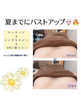 アイリス(AIRIS)/バストアップ/バストケア/リンパ