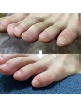 ビビィ(vivie)/爪先のストレスにサヨナラ！