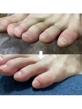 ビビィ(vivie)/爪先のストレスにサヨナラ！