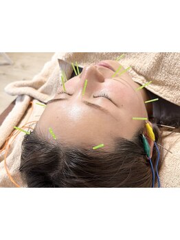 小顔になりたい