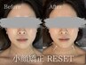 【小顔+美くびれ+姿勢改善コース】RESET全身整体+全身骨格矯正¥10000