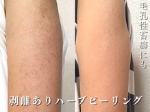 ダリア(Dahlia)/触りたくなるツルツルな腕に