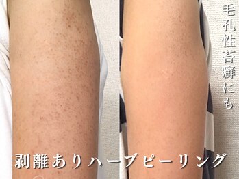 ダリア(Dahlia)/触りたくなるツルツルな腕に