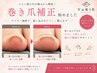 【痛み軽減】巻き爪ワイヤー補正1本￥8800