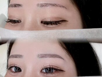 ホワイトアイ 心斎橋(WHITEEYE)/【眉毛/まゆげ】Before/After