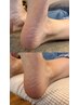 【おすすめセットメニュー!!】フットシンプルコース+角質ケア