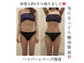 シャルム(CHARME)/ハイパーシリーズコンプリート