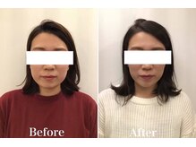 池袋東口整体院/美容整体×小顔矯正