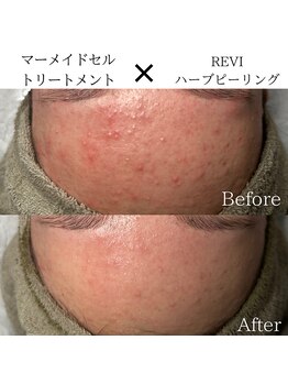 ビューティービューティー(BEAUTY BEAUTY)/