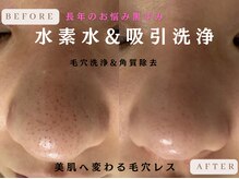 クリア 麻布十番(CLEAR)の雰囲気（《人気韓国肌管理》ハイドラ毛穴洗浄黒ずみ|毛穴|たるみ改善）