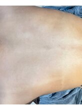 リベル 名古屋(Lebelle:)/ハーブピーリング専門名古屋