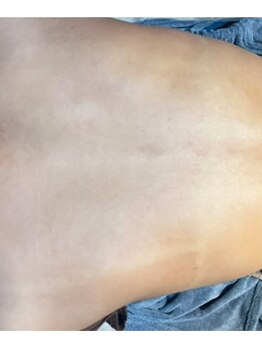 リベル 名古屋(Lebelle:)/ハーブピーリング専門名古屋