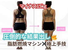 インプルーブ エステティック(Improve ESTHETIC)