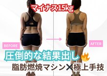 インプルーブ エステティック(Improve ESTHETIC)