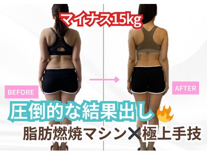 インプルーブ エステティック(Improve ESTHETIC)の写真
