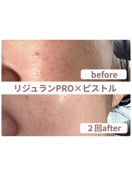 お肌をきれいにしたい