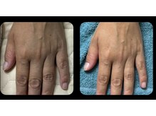 すずき接骨院/手元美人