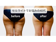 ヨサパーク プアメリア 桜木町(YOSA PARK Pua melia)