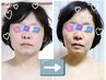 【人気No.1】水素吸入×よもぎ蒸し★本気のスピード痩せ!16800円相当 100分