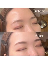 スパーブ(Superb)/平行アーチ