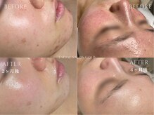 ●Ｂefore→Ａfter