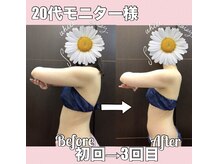 スワン 新栄店(SWAN)の雰囲気(ブライダル6回コース/ハイパーナイフ肩甲骨はがし脂肪分解メディ)