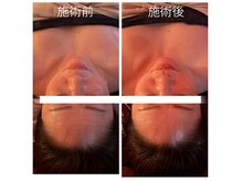 シーエスケイサロン(CSK salon)/バザルトヘッドスパ