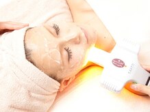 お顔脱毛をしたいのですが肌ダメージが心配です。それに本当に美肌になりますか？