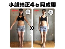 小顔ナチュラル(Natural)の雰囲気（身体からの矯正なので、トータルでお悩み改善に（例：O脚調整））