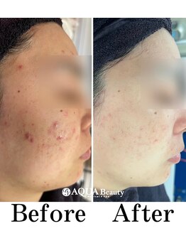 ビーエスアクアビューティー/