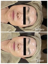 ジャスミン(Jasmin)/エステティック×シェービング