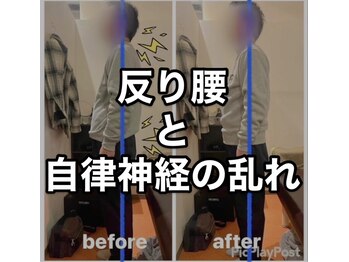 カワル整体 上通り院/反り腰からくる自律神経の乱れ