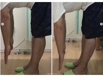 こころ整骨院 こころ鍼灸院/腰痛