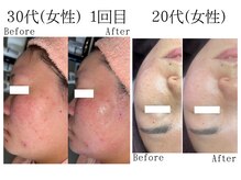 クレアルーチェ 名駅店(crealuce)の雰囲気（ヒト幹細胞は国産の高濃度のみ使用◎炭酸とのW導入で再生美容◎）