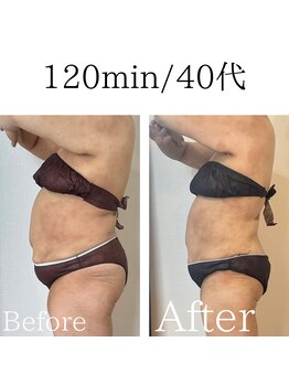 米香(MAIKA)/120分/40代/12回/マイナス5キロ