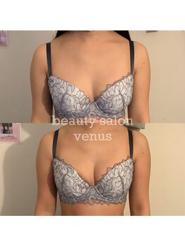 ヴィーナス(Venus)/バストアップで二の腕もスッキリ