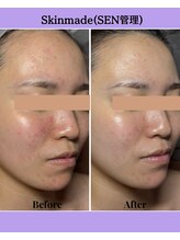 ラ ジェム(La gemme)/【SEN管理】