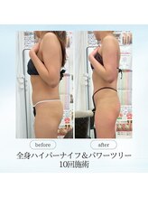 エスプレッソ(espresso,)/【全身痩身10回】お体の厚み撃退
