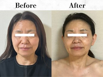 メイヴィ 四日市(Maivi)/60代女性の変化