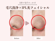 スキンラボ カホクカイ(KaHokuKai)