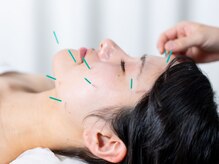 登美ヶ丘治療院の雰囲気(中医鍼灸で体質から整え根本ケア体の内側から引き出す本来の美肌)
